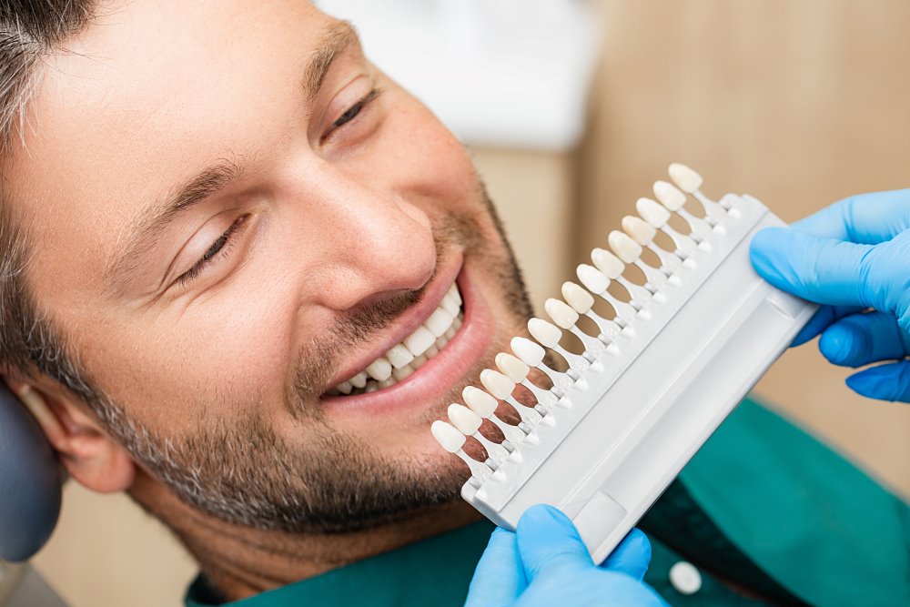 Veneers in sharjah | Dr Hawraa